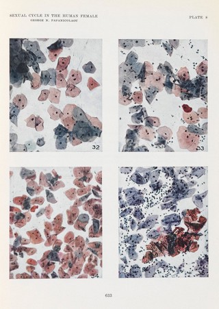 The sexual cycle in the human female as revealed by vaginal smears / George N. Papanicolaou.