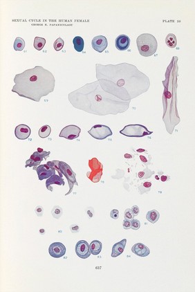 The sexual cycle in the human female as revealed by vaginal smears / George N. Papanicolaou.