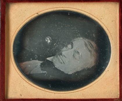 An elderly man after his death. Photograph, 1840/1855.