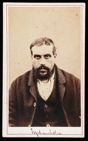 William Wilkinson, a patient at the West Riding Lunatic Asylum, Wakefield, Yorkshire. Photograph attributed to James Crichton-Browne, ca. 1872.