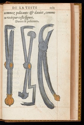 La methode curative des playes, et fractures de la teste humaine. : Avec les pourtraits des instruments necessaires pour la curation d'icelles. / Par M. Ambroise Paré.