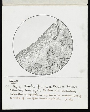 view Drawing of the 1918 Influenza: Trachea showing particular retention of epithelium, by, and in the neighbourhood of duet [?] of one of the mucus glands.