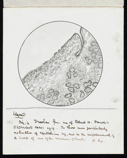 Drawing of the 1918 Influenza: Trachea showing particular retention of epithelium, by, and in the neighbourhood of duet [?] of one of the mucus glands.