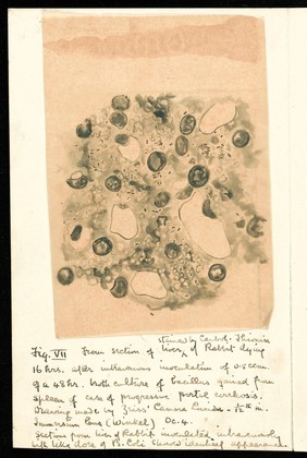 Drawing of the 1918 Influenza: section of the liver of rabbit