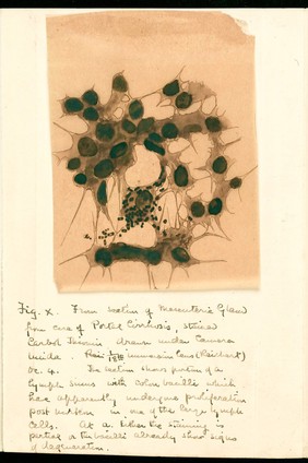 Drawing of the 1918 Influenza: section of mescuterie gland