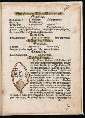 Ausslegung und Beschreybung der Anatomi, oder, warhafften Abconterfetung eines inwendigen Cörpers des Manns und Weybes : mit Erklerung seiner innerlichen Gelider, wie und wo hyn ein yedes von Gott erschaffen un[d] geordnet, das menschlich Leben zu auffenthalten / [Attrib. to Heinrich Vogtherr].