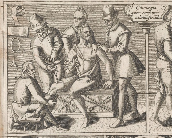 Le chirurgie françoise recueillie des antiens médecins et chirurgiens. Avec plusieurs figures des instrumens necesseres pour l'opération manuelle / Par Iacques Guillemeau.