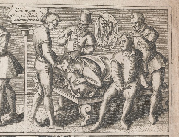 Le chirurgie françoise recueillie des antiens médecins et chirurgiens. Avec plusieurs figures des instrumens necesseres pour l'opération manuelle / Par Iacques Guillemeau.