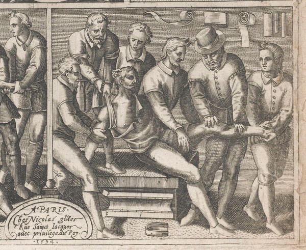 Le chirurgie françoise recueillie des antiens médecins et chirurgiens. Avec plusieurs figures des instrumens necesseres pour l'opération manuelle / Par Iacques Guillemeau.
