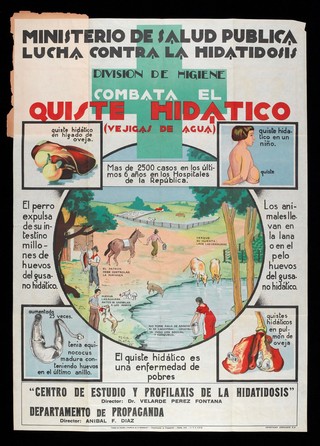 Hydatidosis (echinococcosis): how it is caught, and what the symptoms look like. Colour lithograph by Peña Plata, ca. 1937.