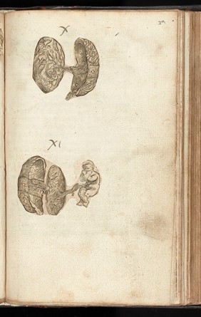 The byrth of mankynde, otherwyse named the womans booke : Newly set furth, corrected and augmented. Whose co[n]tentes ye maye rede in the table of the booke, and most playnly in the prologue / By Thomas Raynold phisition.