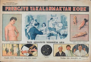 view Syphilis: its symptoms, transmission and consequences in Turkey. Colour lithograph by Refet Başokçu, 193-.