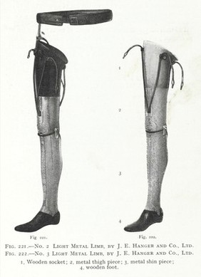 Artificial limbs and amputation stumps : a practical handbook / by E. Muirhead Little.