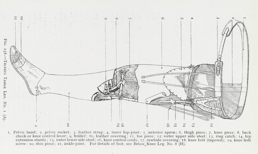 Artificial limbs and amputation stumps : a practical handbook / by E. Muirhead Little.
