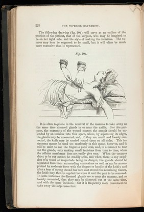 A system of practical surgery / By William Fergusson ; with illustrations by Bagg.