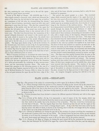 A treatise on operative surgery comprising a description of the various processes of the art, including all the new operations; exhibiting the state of surgical science in its present advanced condition; with eighty plates, containing four hundred and eighty-six separate illustrations. Second edition, revised and enlarged / by Joseph Pancoast.