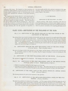 A treatise on operative surgery comprising a description of the various processes of the art, including all the new operations; exhibiting the state of surgical science in its present advanced condition; with eighty plates, containing four hundred and eighty-six separate illustrations. Second edition, revised and enlarged / by Joseph Pancoast.