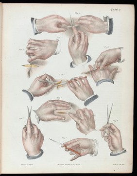 A treatise on operative surgery comprising a description of the various processes of the art, including all the new operations; exhibiting the state of surgical science in its present advanced condition; with eighty plates, containing four hundred and eighty-six separate illustrations. Second edition, revised and enlarged / by Joseph Pancoast.