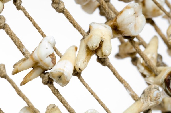 Doctor's signboard hung with human teeth