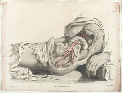 The anatomy of the arteries of the human body and its applications to pathology and operative surgery with a series of lithographic drawings / / by Richard Quain. The drawings from nature and on stone by Joseph Maclise.