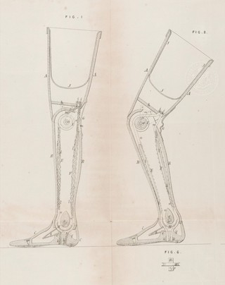 Specification of William Edward Newton : artificial legs.