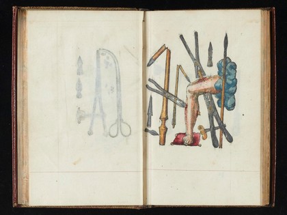 Instrumenta chyrurgiae et icones anathomicae / [Ambroise Paré].