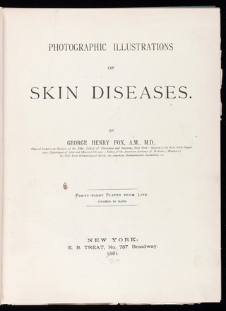 Photographic illustrations of skin diseases / by George Henry Fox.