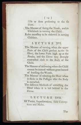 A course of lectures on midwifery / [Christopher Kelly]