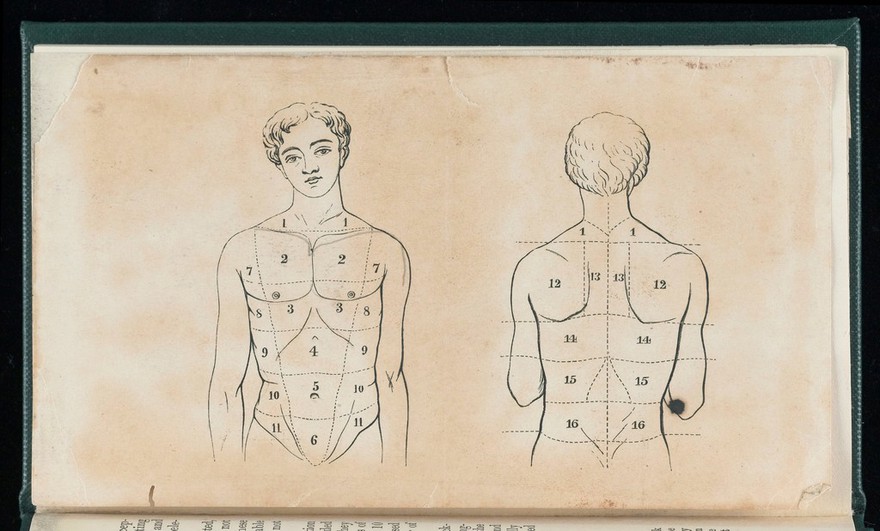 The student's guide to medical diagnosis / by Samuel Fenwick.
