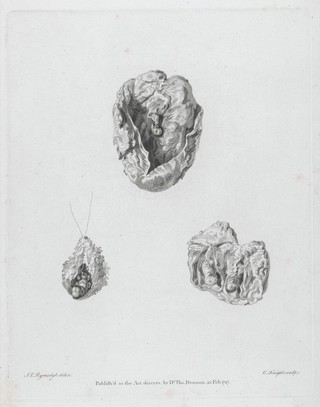 A collection of engravings tending to illustrate the generation and parturition of animals and of the human species / [Thomas Denman].