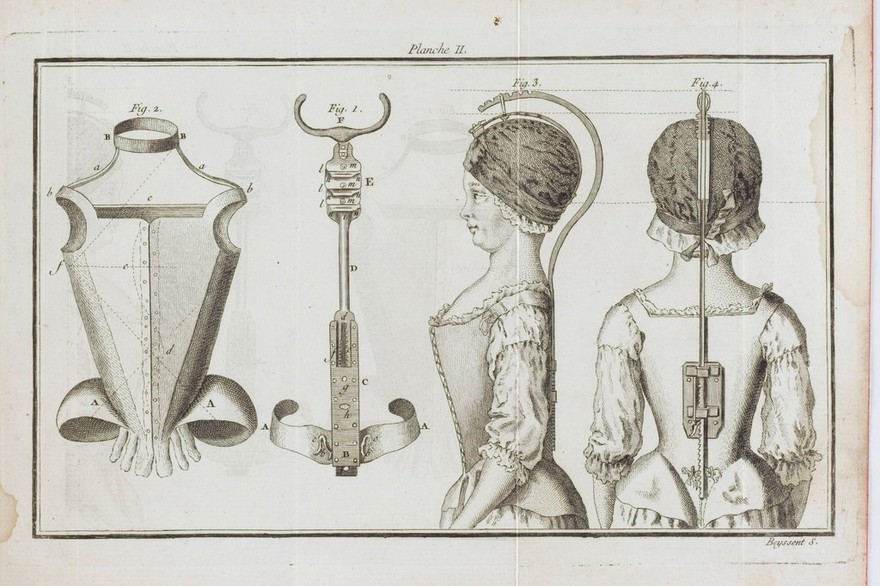 Traité du rakitis, ou l'art de redresser les enfants contrefaits / [Thomas Levacher de la Feutrie].