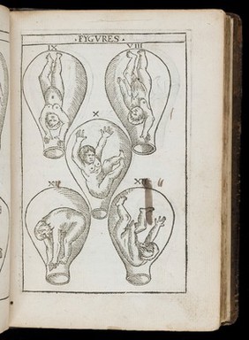 The birth of mankynde : otherwyse named the womans booke. / Newly set forth, corrected, and augmented. Whose contentes ye may reade in the table of the booke, and most playnely in the prologue. By Thomas Raynalde phisition.