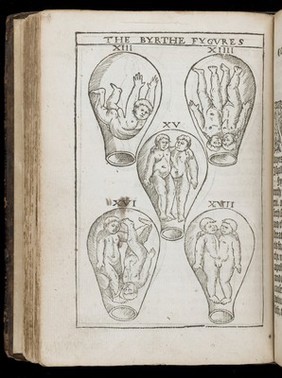 The birth of mankynde : otherwyse named the womans booke. / Newly set forth, corrected, and augmented. Whose contentes ye may reade in the table of the booke, and most playnely in the prologue. By Thomas Raynalde phisition.