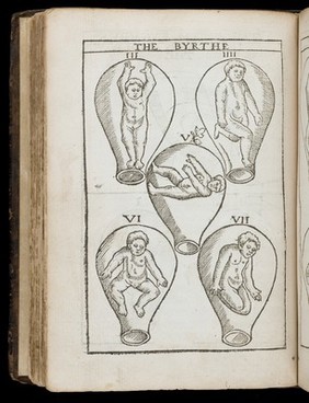 The birth of mankynde : otherwyse named the womans booke. / Newly set forth, corrected, and augmented. Whose contentes ye may reade in the table of the booke, and most playnely in the prologue. By Thomas Raynalde phisition.