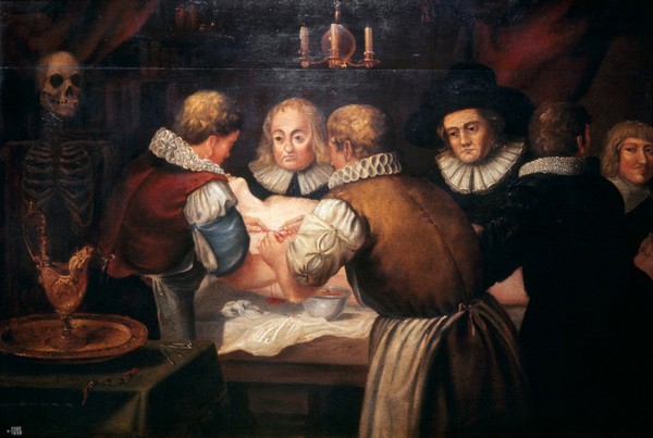 Surgeons performing an operation on a woman's breast in the seventeenth century. Oil painting, 18-- (?).