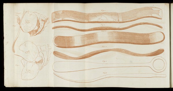 A system of obstetrical tables, with explanations; representing the foundations of the theory and practice of midwifery / [John Aitken].