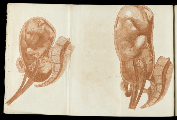 A system of obstetrical tables, with explanations; representing the foundations of the theory and practice of midwifery / [John Aitken].