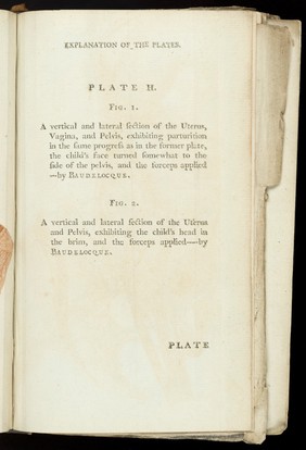 A system of obstetrical tables, with explanations; representing the foundations of the theory and practice of midwifery / [John Aitken].