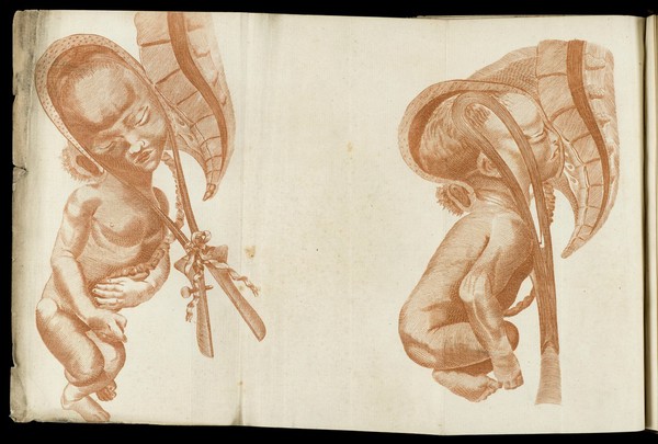 A system of obstetrical tables, with explanations; representing the foundations of the theory and practice of midwifery / [John Aitken].