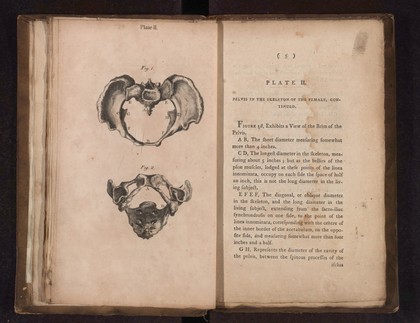 A collection of engravings designed to facilitate the study of midwifery, explained and illustrated / [James Hamilton].