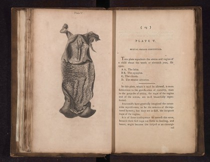 A collection of engravings designed to facilitate the study of midwifery, explained and illustrated / [James Hamilton].