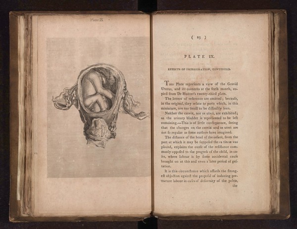 A collection of engravings designed to facilitate the study of midwifery, explained and illustrated / [James Hamilton].