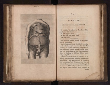 A collection of engravings designed to facilitate the study of midwifery, explained and illustrated / [James Hamilton].