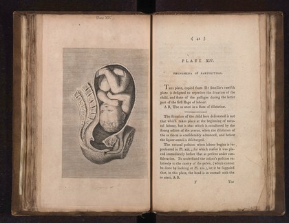 A collection of engravings designed to facilitate the study of midwifery, explained and illustrated / [James Hamilton].