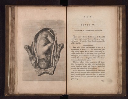 A collection of engravings designed to facilitate the study of midwifery, explained and illustrated / [James Hamilton].