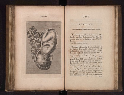 A collection of engravings designed to facilitate the study of midwifery, explained and illustrated / [James Hamilton].