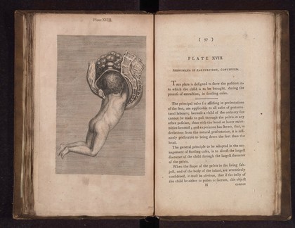 A collection of engravings designed to facilitate the study of midwifery, explained and illustrated / [James Hamilton].