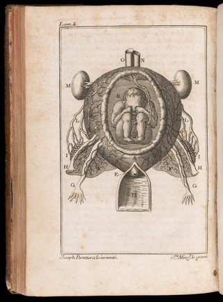 Preceptos generales sobre las operaciones de los partos : este tratado es una exposicion completa del arte obstetrice, en el qual se explican con la mayor especies de partos : esta adicionado con advertencias y notas de lo mejor que han escrito los profesores modernos : ilustrado con observaciones prácticas muy instructivas, y adornado con láminas finas : escrito particularmente para la instruccion de los cirujanos partidarios / Don Joseph Ventura Pastor.