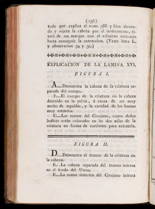 Preceptos generales sobre las operaciones de los partos : este tratado es una exposicion completa del arte obstetrice, en el qual se explican con la mayor especies de partos : esta adicionado con advertencias y notas de lo mejor que han escrito los profesores modernos : ilustrado con observaciones prácticas muy instructivas, y adornado con láminas finas : escrito particularmente para la instruccion de los cirujanos partidarios / Don Joseph Ventura Pastor.
