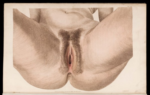 Anatomico-chirurgical views of the male and female pelvis : with appropriate explanations and references to the parts / by John James Watt ; the engravings executed from original drawings by Lewis.